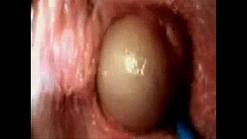 camera inside vagina tube