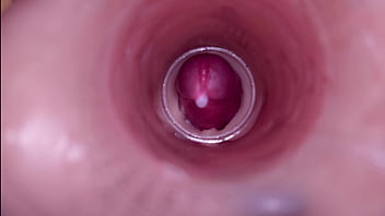 ejaculation interne massive