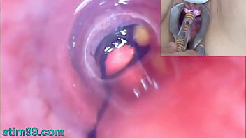 rectal exam porn